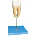 MOLAR MODEL